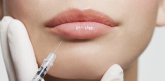 5 Things to Know Before You Getting Dermal Fillers